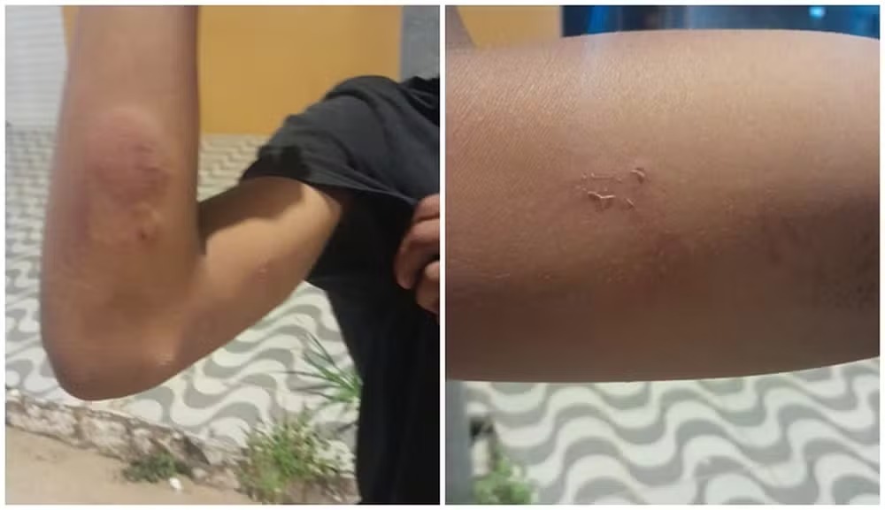 Caso aconteceu na Escola Municipal Valdevino Ribeiro, em Curral de Cima - Foto: Reprodução/internet